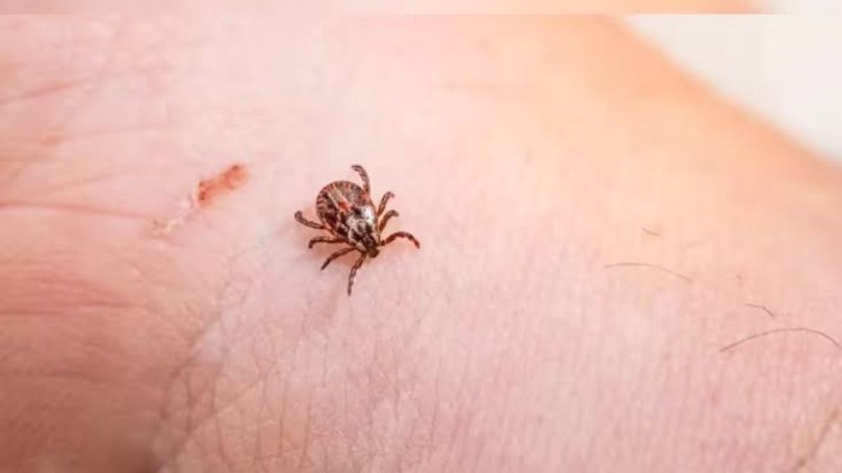 Ticks Are Spreading Anaplasmosis, Not Just Lyme Disease, CMAJ Warns